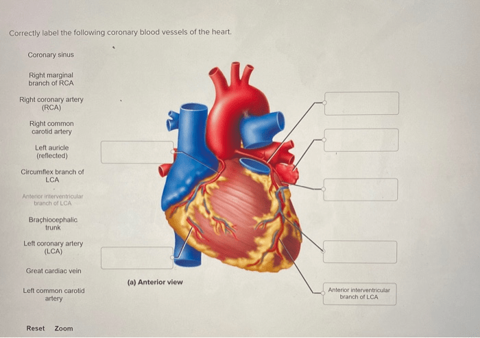 Correctly label the following coronary blood vessels of the heart.